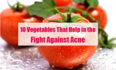 If you've always believed chocolate and oily foods cause acne, it's finally time to put that myth to rest. 

